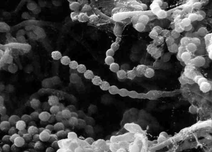 진균 03 17 Paecilomyces spp. 위험군 : 제 2위험군 국내범주 :- 특성 :Trichocomaceae과 출처 :CDC/ Janice Haney Carr 병원성및감염증상 잠복기 : 숙주및종에따라수일에서수주 spp.