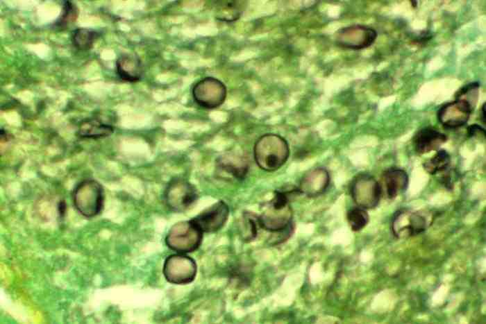 진균 03 19 Pneumocystis jirovecii ( 구 P. carinii) 위험군 : 제 2위험군 국내범주 :- 특성 :Pneumocystidaceae과 출처 :CDC/ Dr. Edwin P. Ewing, Jr.