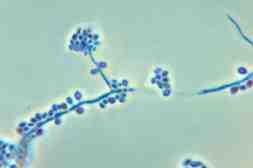 진균 03 20 Sporothrix schenckii 위험군 : 제 2위험군 국내범주 :- 특성 :Ophiostomataceae 과, 두형태진균 (Dimorphic fungi), 전세계적으로발생 출처 :CDC/Dr.