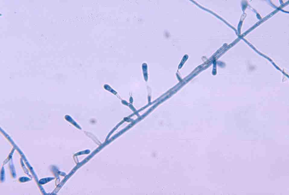 진균 03 23 Verruconis gallopava ( 구 Dactylaria(Ochroconis) gallopava) 위험군 : 제 2위험군 국내범주 :- 특성 :Sympoventuriaceae과, 국내보고없음 출처 :CDC//Dr. Merrill Ranck, Dr.