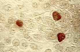 세균 01 21 Chlamydia trachomatis 위험군 : 제 2위험군 국내범주 :- 특성 :Chlamydiaceae 과, 그람음성, 운동성없음, 기본소체 (elementary body) 는둥근공형태, 절대기생세균 출처 :CDC/ Dr. E. Arum; Dr. N.