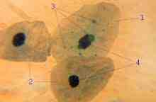 세균 01 23 Chlamydophila pneumoniae 위험군 : 제 2위험군 국내범주 :- 특성 :Chlamydiaceae 과, 그람음성, 운동성없음, 기본소체 (elementary body) 는원형질막주위공간이있어서양배형태, 절대기생세균 출처 :https://commons.wikimedia.