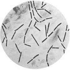 2017 병원체생물안전정보집 ( 제 2, 3, 4 위험군 ) 28 Clostridium spp.(c. chauvoei, C. haemolyticum, C. histolyticum, C. novyi, C.