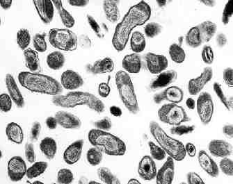 세균 01 31 Coxiella burnetii 위험군 : 제 3위험군 국내범주 : 고위험병원체, 생물작용제, 전략물자통제병원체 특성 :Coxiellaceae 과, 세포내절대기생세균, ph 4.