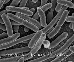 2017 병원체생물안전정보집 ( 제 2, 3, 4 위험군 ) 36 Escherichia coli (Pathogenic) 출처 :CDC, NIAID 위험군 : 제 2위험군 국내범주 : 전략물자통제병원체 ( 시가독소 (Shiga toxin) 을생성하는 O26, O45, O103, O104, O111, O121, O145,