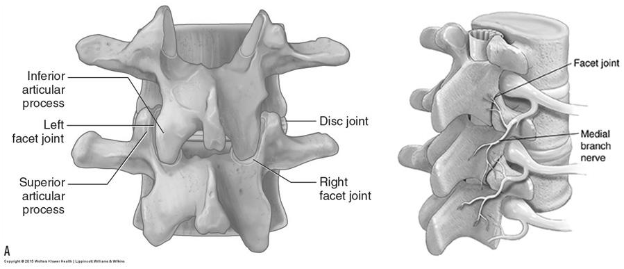 정호순 : Lumbar Spine (Interlaminar/Transforaminal Approach, MBB) Figure 2. Lumbar epidural block - Infraneural approach 다. B.