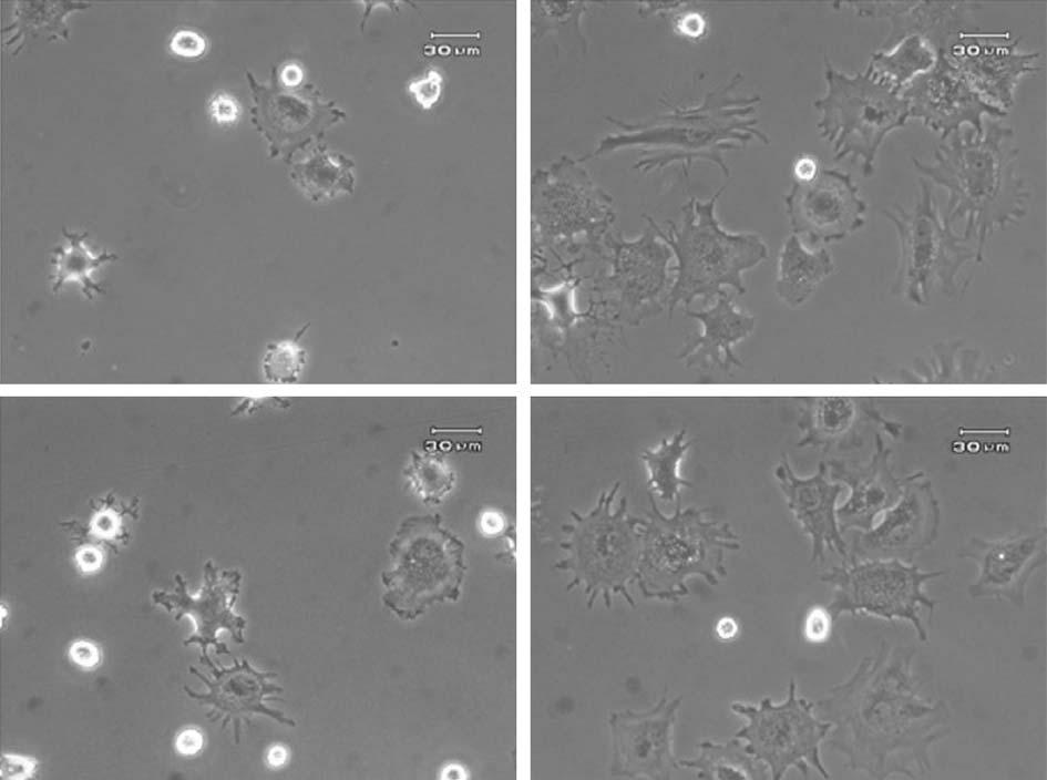 대한정형외과연구학회지제 10 권제 2 호 2007 년 A B C Fig. 1. Microscopic morphological features of attached articular chondrocytes.
