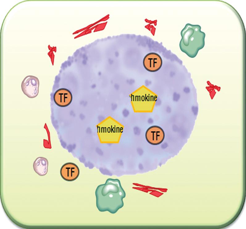 (D) Amplified by platelets, thrombin generates more fibrin creating a capsule containing platelets, PMNs, and monocytes surrounding the islets. Chemotactic factors (e.g., C5a and IL-8) that were released as a consequence of IBMIR or released directly from the islets (e.