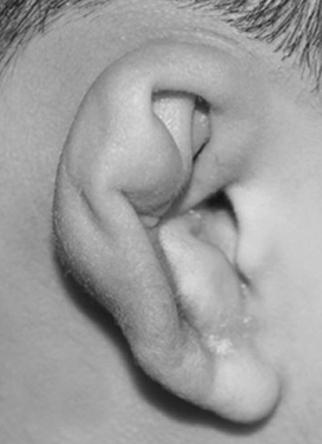 Relationship between normal ear wrestlers and deformed ear wrestlers Characteristic No.