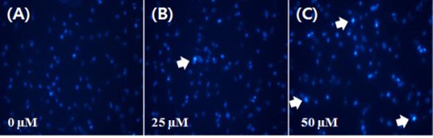 234 장혜연 이송희 안인정 이해님 김혜리 박영석 박병권 김병수 김상기 조성대 남정석 최창순 정지윤 Fig. 3. Effect of delphinidin on the chromatin condensation in MDA-MB-231 cells.