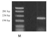 MG-63 세포주에서 Vascular Endothelial Growth Factor (VEGF) mrna 발현에대한 Insulin-like Growth Factor I (IGF-I) 의효과에대한연구 Table 1.