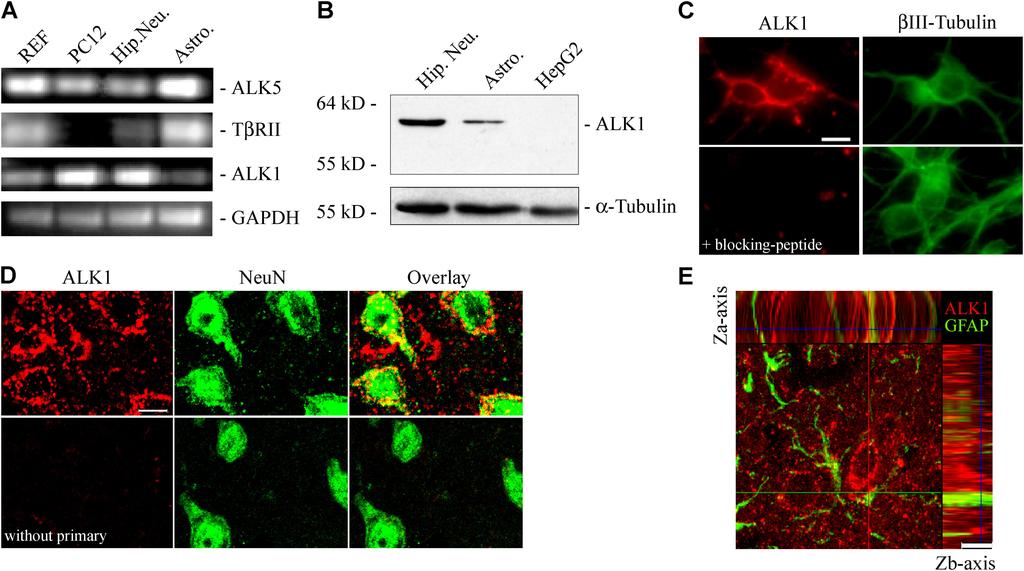 Figure 1. Neuronal cells express the alternative TGF- type I receptor ALK1.