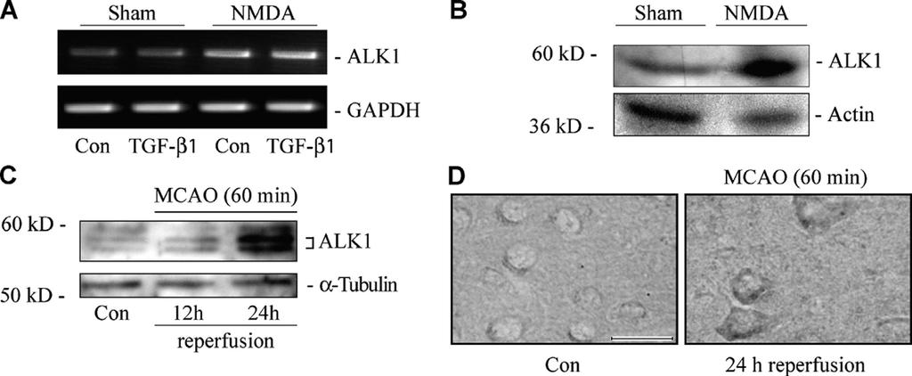 Figure 2. Injury-induced up-regulation of ALK1 receptor in vitro and in vivo. Evaluation of ALK1 mrna (A) and protein levels (B) 24 h after a brief exposure to excitotoxic NMDA (300 M; 5 min).