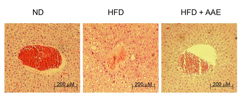 Su-Jin Park et al. 64 한편, 간의 지방증 발생 및 이로 인한 조직 손상의 지 지방 축적이 발생한 마우스에서는 대표적인 지방 합성 표로써 혈청 내 AST 및 ALT 수준을 분석한 결과는 Fig. 관련 유전자인 SREBP-1c 및 이로 인한 FAS 단백질의 2B와 같다.
