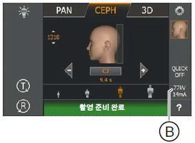 SL을이용한어린이와청소년의선량감소방법은아래와같다. 1.