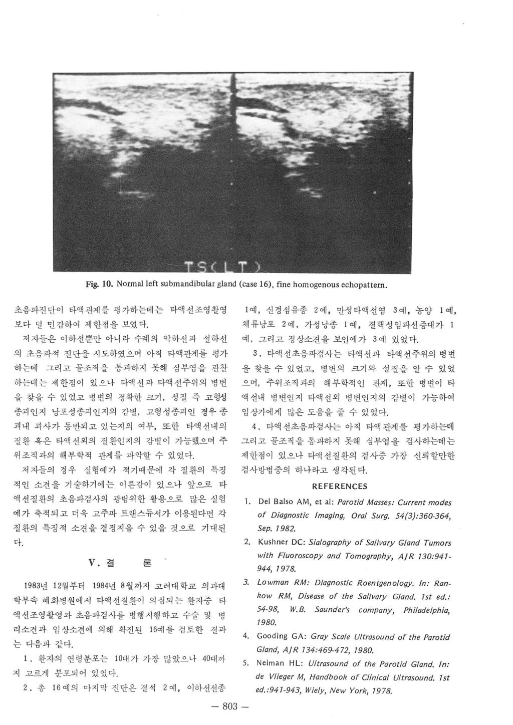 Fig. 0. Normalleft submandibular gland (case 6), fine homogenous echopattern. 초음파진단이타액관계플평가하는데는타액션조영촬영 보다덜민감하여제한점을보였다.