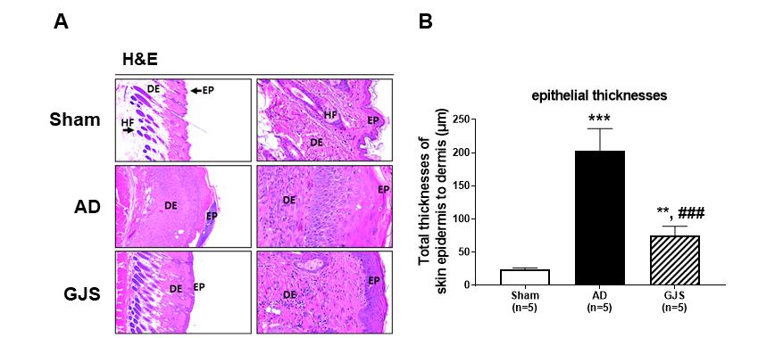 손미주외 4 인 : DNCB 로유발된아토피피부염동물모델에대한藿香正氣散경구투여의효과 Fig. 4. Histologic Features of Skin Lesion and Epithelial Thickness (A) H&E staining and (B) Change of epithelial thickness after GJS treatment.
