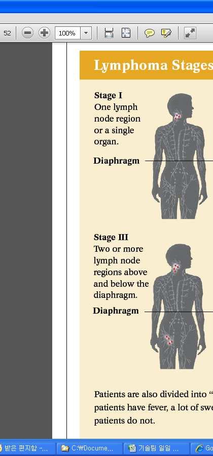 Hodgkin Lymphoma Subtypes 호지킨림프종의하위유형 Knowing your subtype helps the doctor make treatment decisions. Below are the names of the different Hodgkin lymphoma subtypes.