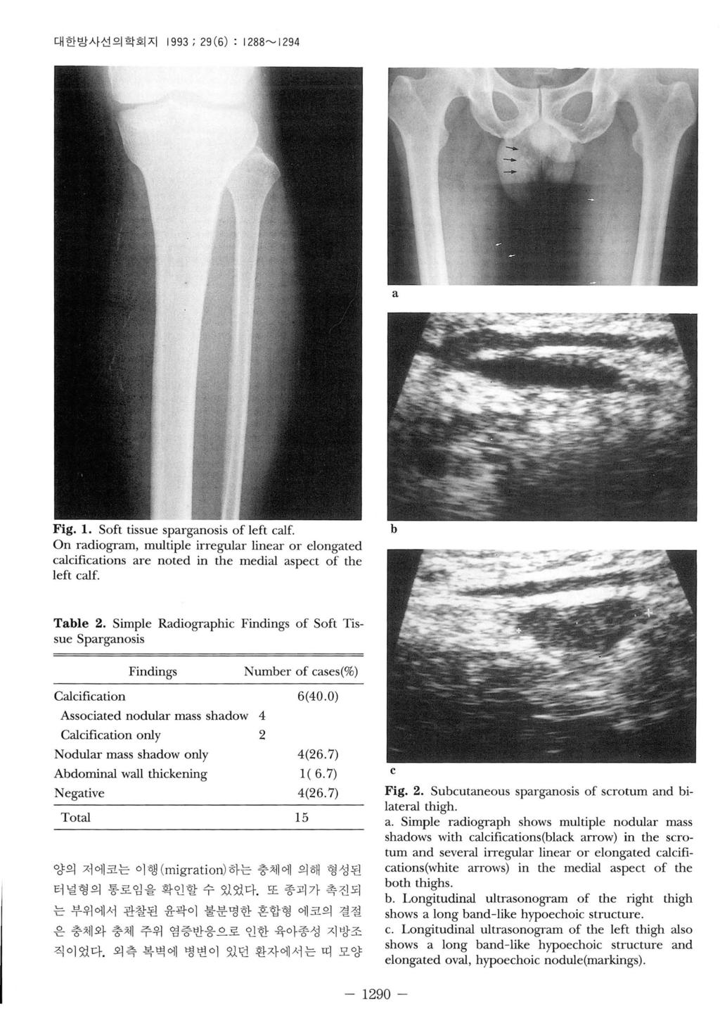 대한방사선의학회지 1993 ; 29 (6) : 1288~ 1294 a Fig. 1. Soft tissue sparganosis of left calf.