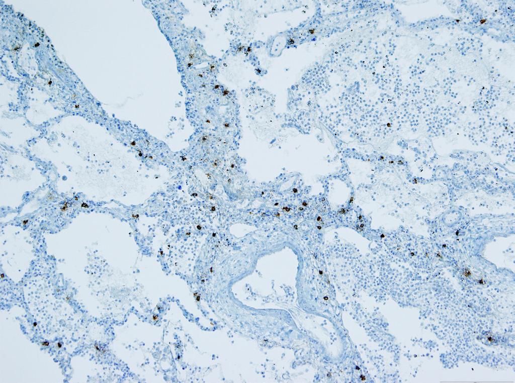 degranulation staining pattern in the