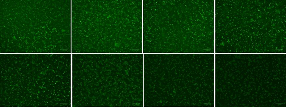 1:256(x1) Figure 6. Positive results of immunofluorescence assay test according to dilution factor for sample (3997).