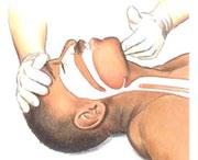 환자의얼굴과가슴을 10초이내로관찰하여호흡이있는지를확인합니다.