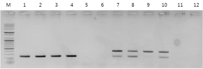 Fig. 2. Agarose gel electrophoresis (1%) of DNA fragment after PCR amplification with the sequence specific primer set (P-SF2, F-SF3, and C-SR3) from the individual genomic DNA of M.