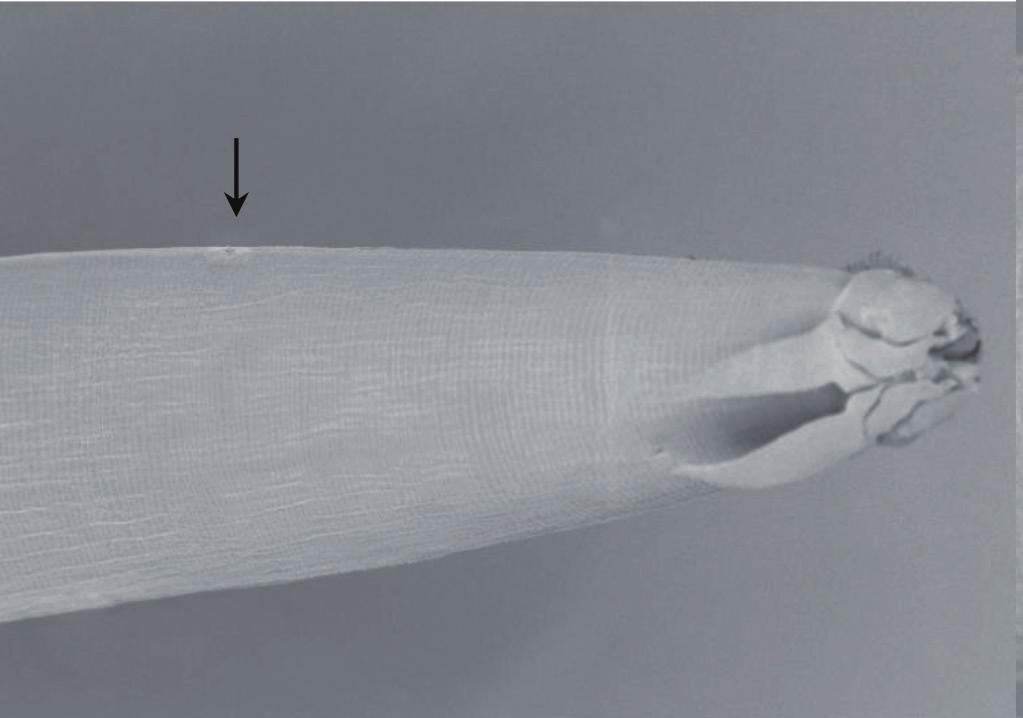They also used the length and shape of the spicules and the number of cloacal papillae [12]. Pinto et al.