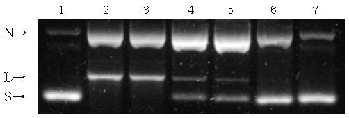 韓資植誌 Korean J. Plant Res. 25(5) : 568~577(2012) (A) (B) Fig. 6. Electrophoresis of pbr322 DNA treated with hydroxyl radical and peroxyl radical in the presence of R. crispus L. extracts.