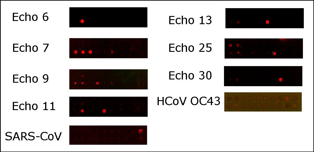 SARS Actin Fig. 4. Detection of 7 respiratory viruses using oligonucleotide DNA chip. DNA probes were spotted in duplicate in an six-by-four grid.