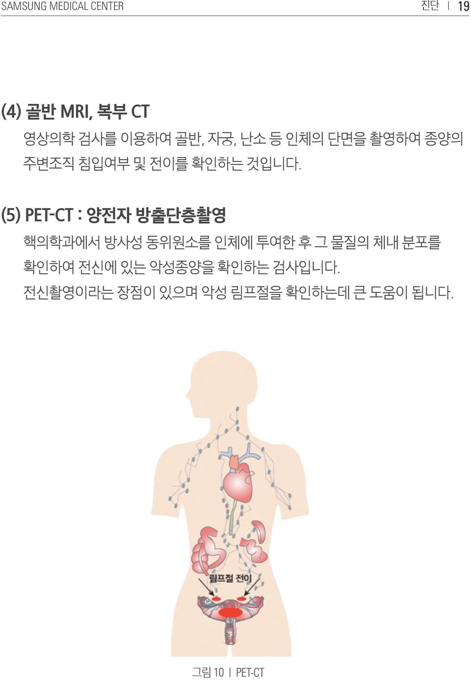 (5) PET-CT : 양전자 방출단층촬영 핵의학과에서 방사성 동위원소를 인체에 투여한 후 그 물질의 체내 분포를