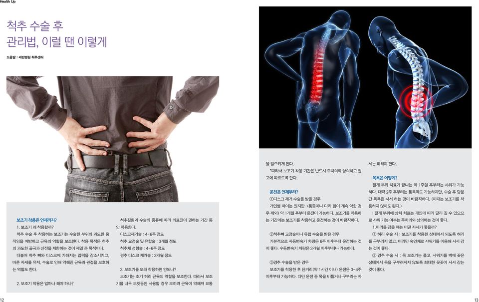 보조기를 착용하 l 절개 부위에 상처 치료는 개인에 따라 달라 질 수 있으므 보조기 착용은 언제까지? 척추질환과 수술의 종류에 따라 의료진이 권하는 기간 동 는 기간에는 보조기를 착용하고 운전하는 것이 바람직하다. 로 샤워 가능 여부는 주치의와 상의하는 것이 좋다. 1. 보조기 왜 착용할까? 안 착용한다. 1.머리를 감을 때는 어떤 자세가 좋을까?