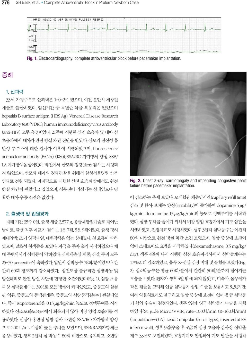 임신기간 중 특별한 약물 복용력은 없었으며 hepatitis B surface antigen (HBS Ag), Venereal Disease Research Laboratory test (VDRL), human immunodeficiency virus antibody (anti-hiv) 모두 음성이었다.