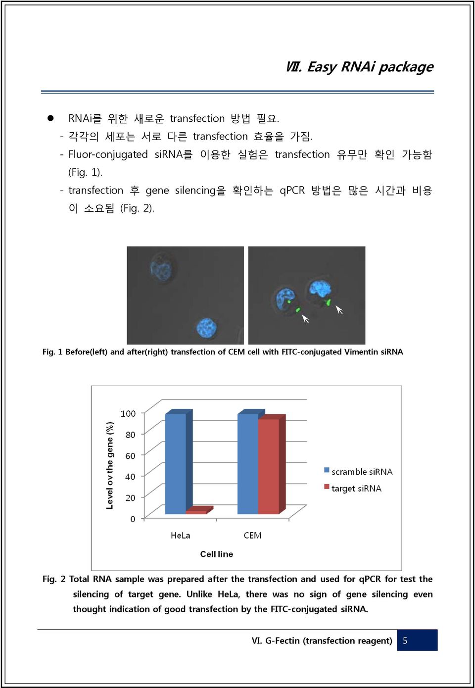 1 Before(left) and after(right) transfection of CEM cell with FITC-conjugated Vimentin sirna Fig.