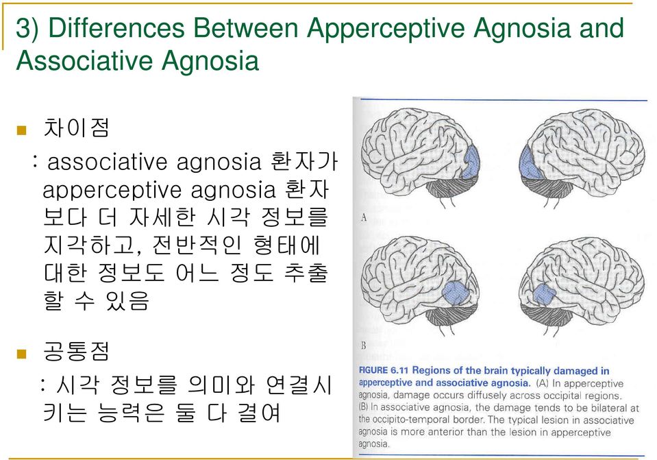 apperceptive agnosia 환자 보다 더 자세한 시각 정보를 지각하고, 전반적인
