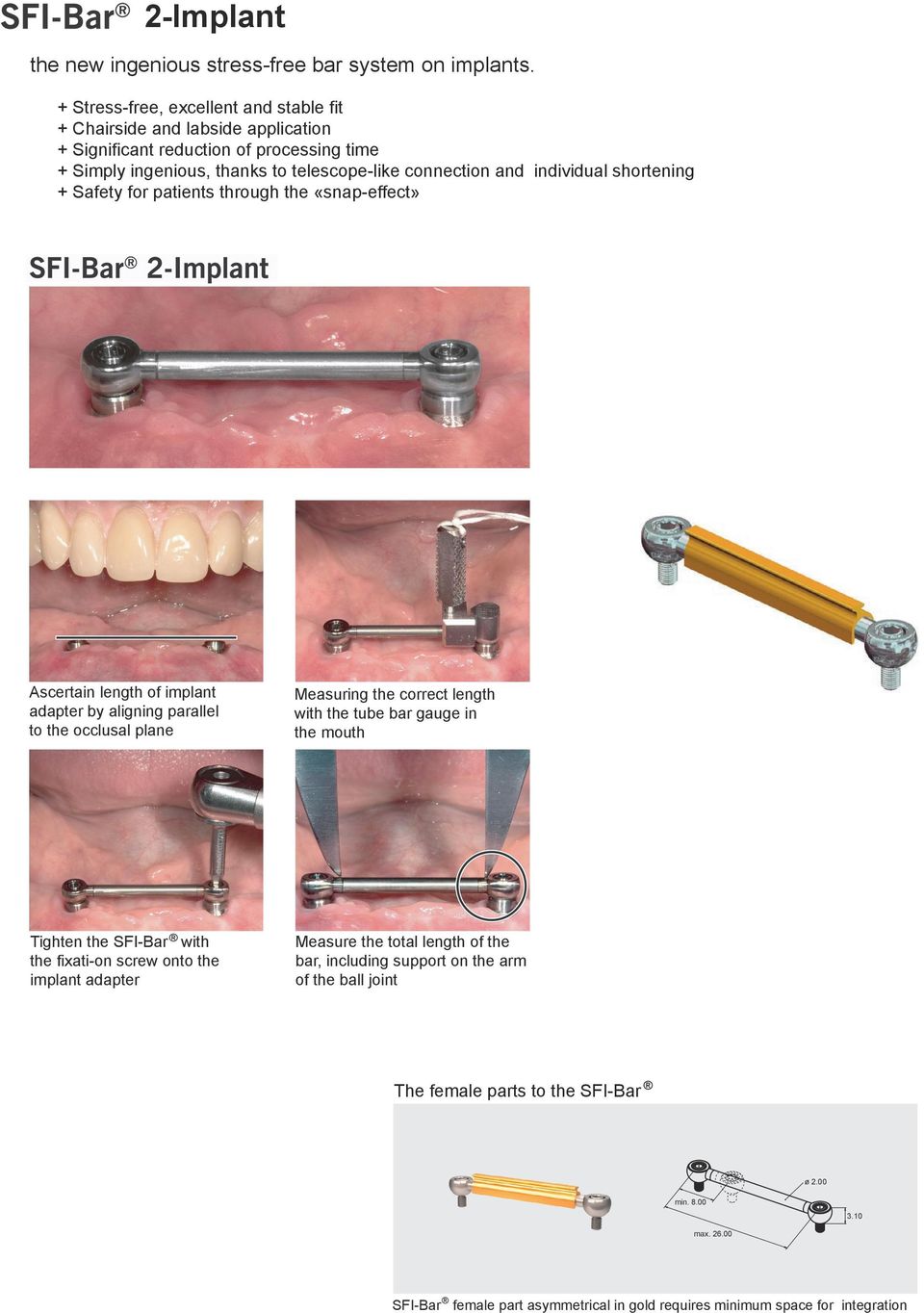 shortening Safety for patients through the «snap-effect» Ascertain length of implant adapter by aligning parallel to the occlusal plane Measuring the correct length with the tube