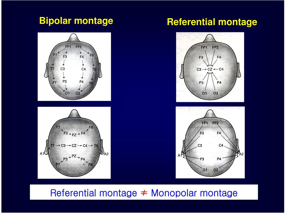 montage g  montage