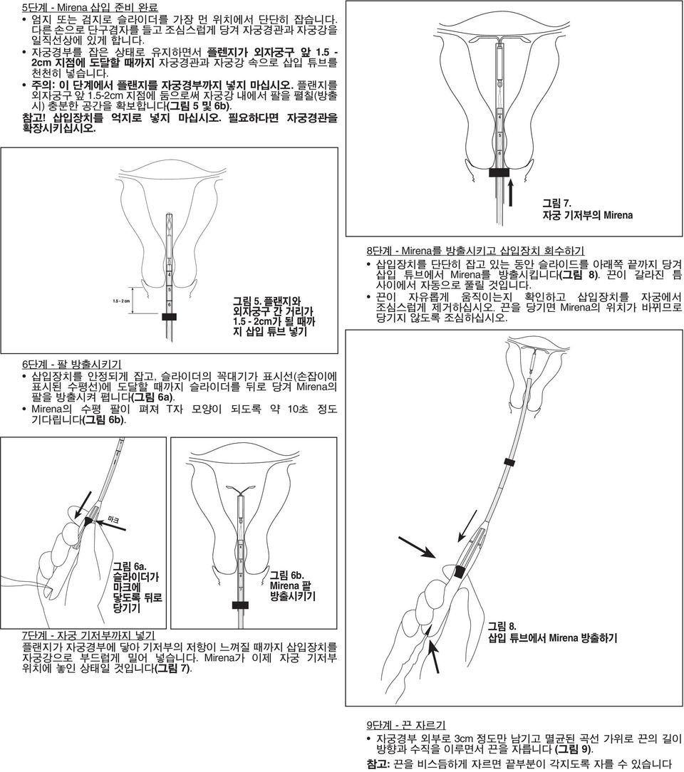 삽입장치를억지로넣지마십시오 필요하다면자궁경관을확장시키십시오 4 5 6 7 그림 7 자궁기저부의 그림 5 플랜지와외자궁구간거리가 15-2cm 가될때까지삽입튜브넣기 8 단계 - 를방출시키고삽입장치회수하기 삽입장치를단단히잡고있는동안슬라이드를아래쪽끝까지당겨삽입튜브에서 를방출시킵니다 ( 그림 8) 끈이갈라진틈사이에서자동으로풀릴것입니다