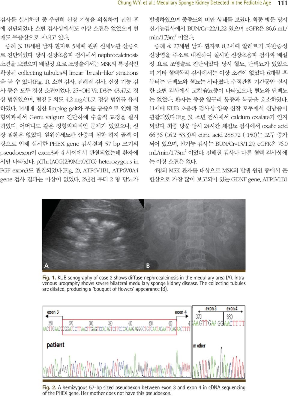 47로 정 상 범위였으며, 혈청 P 치도 4.2 mg/dl로 정상 범위를 유지 하였다. 14세때 심한 limping gait와 무릎 통증으로 인해 정 형외과에서 Genu valgum 진단하에 수술적 교정을 실시 하였다. 어머니도 같은 정형외과적인 문제가 있었으나, 신 장 질환은 없었다.