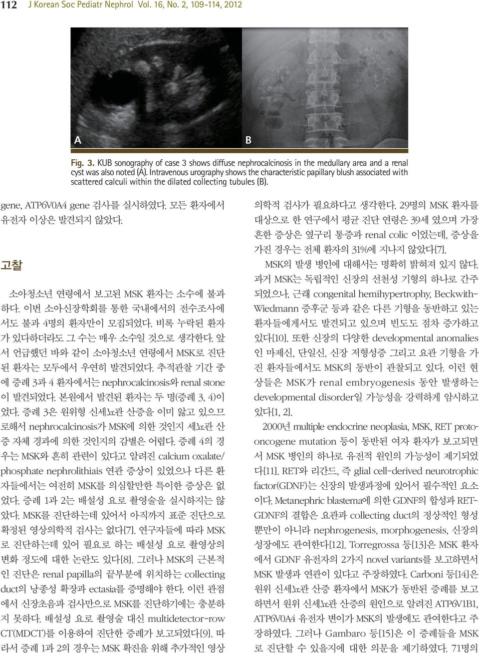 고찰 소아청소년 연령에서 보고된 MSK 환자는 소수에 불과 하다. 이번 소아신장학회를 통한 국내에서의 전수조사에 서도 불과 4명의 환자만이 모집되었다. 비록 누락된 환자 가 있다하더라도 그 수는 매우 소수일 것으로 생각한다. 앞 서 언급했던 바와 같이 소아청소년 연령에서 MSK로 진단 된 환자는 모두에서 우연히 발견되었다.