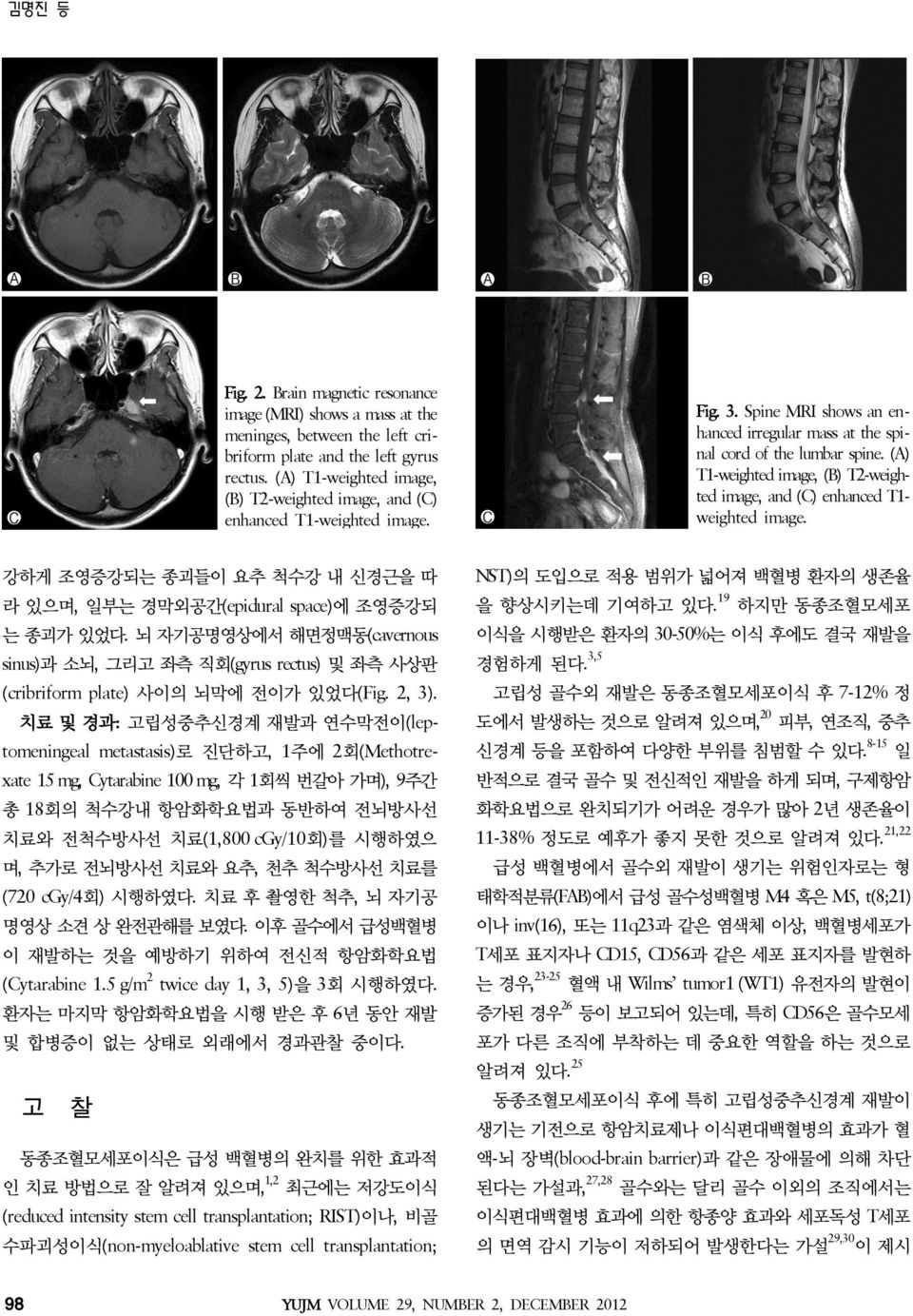 (A) T1-weighted image, (B) T2-weighted image, and (C) enhanced T1weighted image.