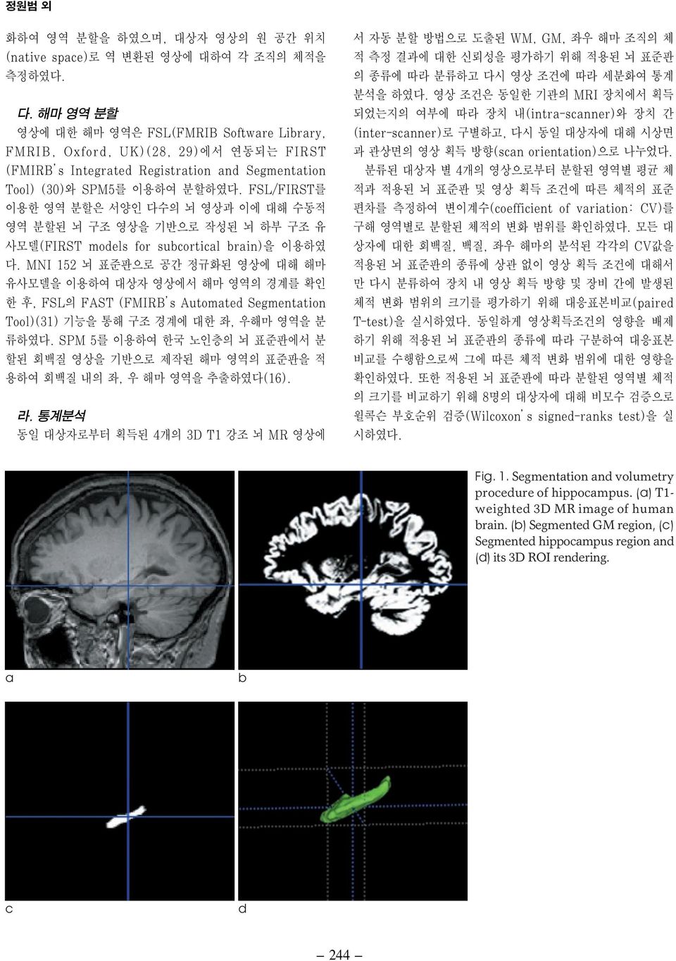 FSL/FIRST를 이용한 영역 분할은 서양인 다수의 뇌 영상과 이에 대해 수동적 영역 분할된 뇌 구조 영상을 기반으로 작성된 뇌 하부 구조 유 사모델(FIRST models for subcortical brain)을 이용하였 다.
