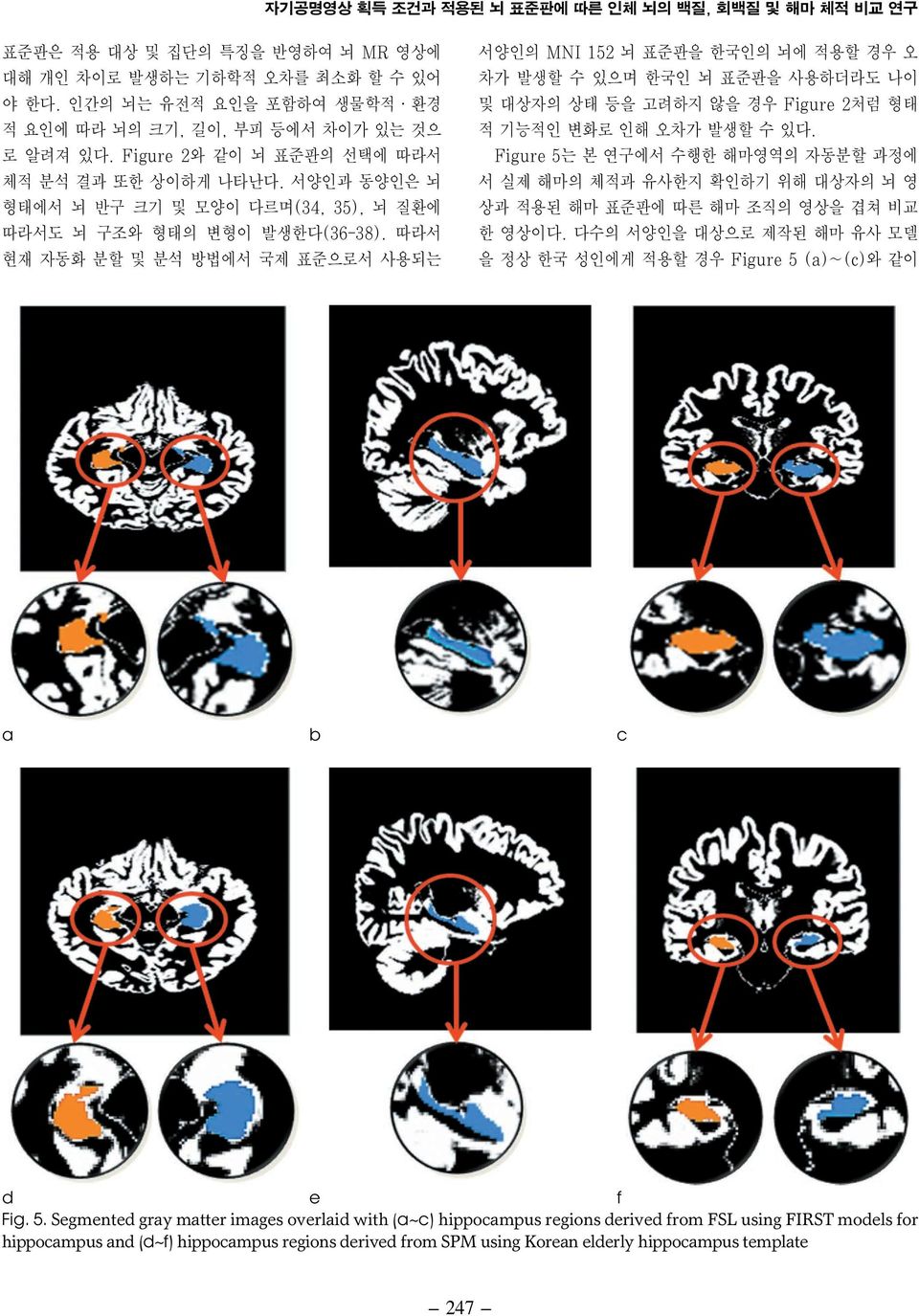 서양인과 동양인은 뇌 형태에서 뇌 반구 크기 및 모양이 다르며(34, 35), 뇌 질환에 따라서도 뇌 구조와 형태의 변형이 발생한다(36-38).