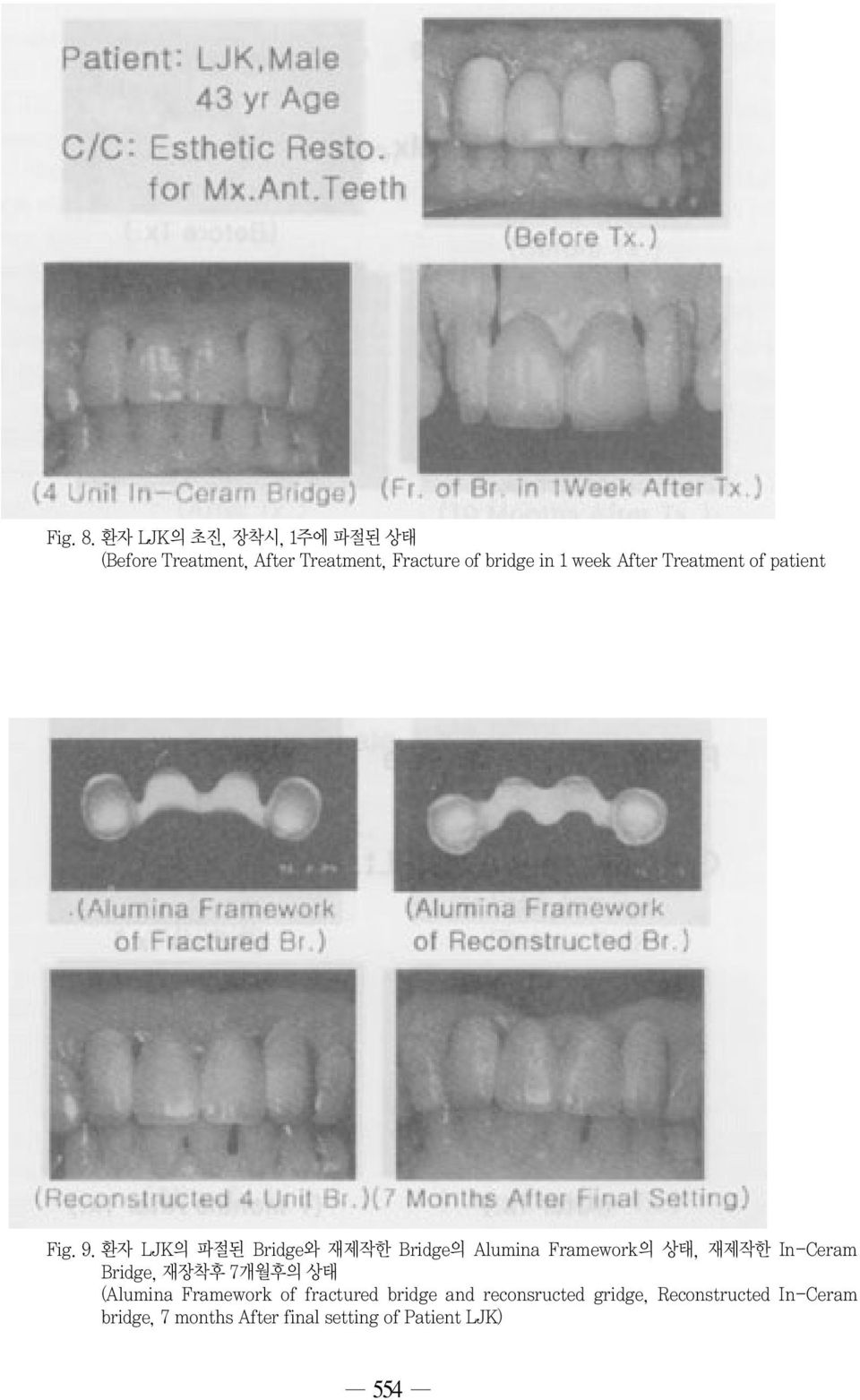 After Treatment of patient Fig. 9.