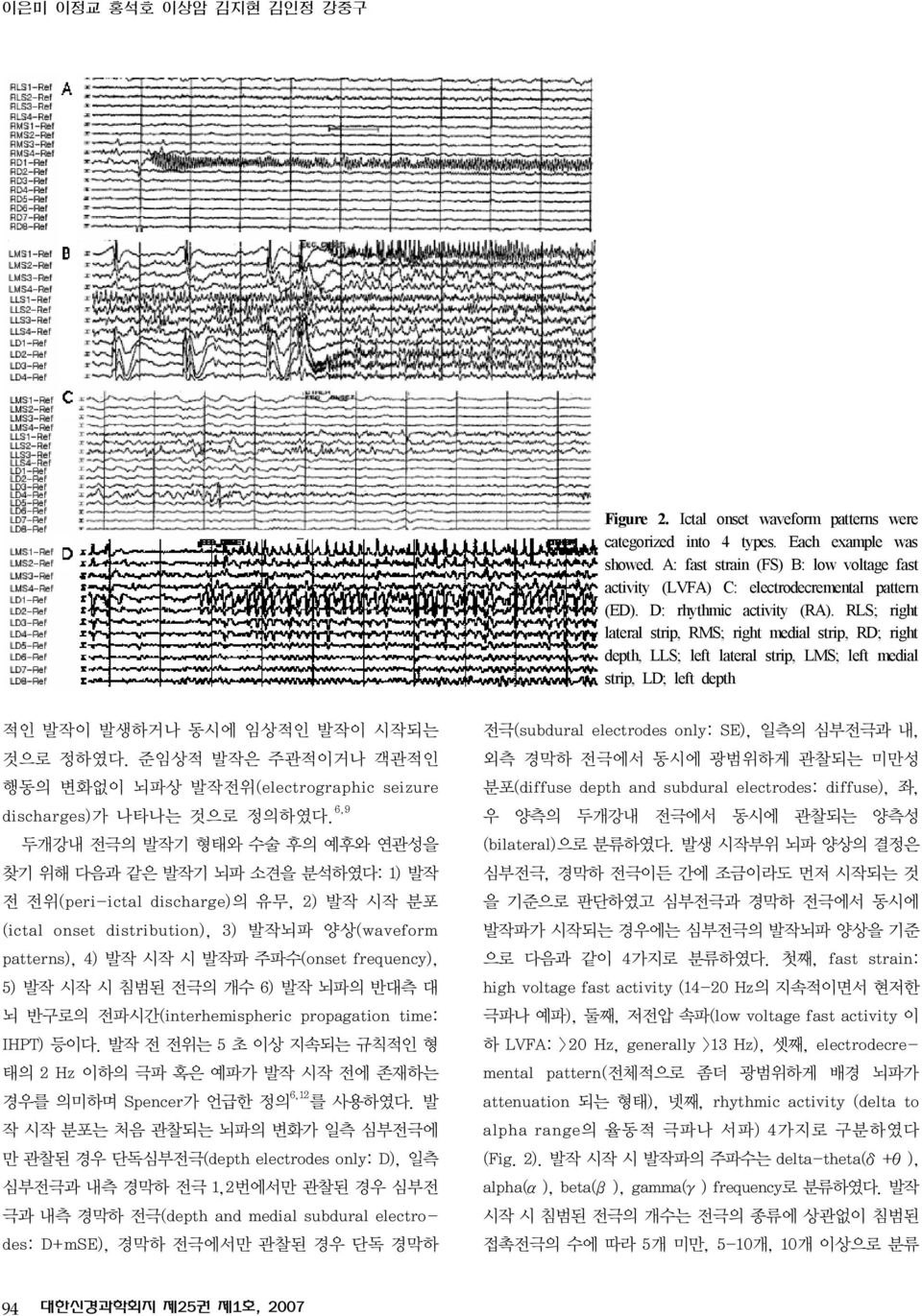 RLS; right lateral strip, RMS; right medial strip, RD; right depth, LLS; left lateral strip, LMS; left medial strip, LD; left depth 적인 발작이 발생하거나 동시에 임상적인 발작이 시작되는 것으로 정하였다.