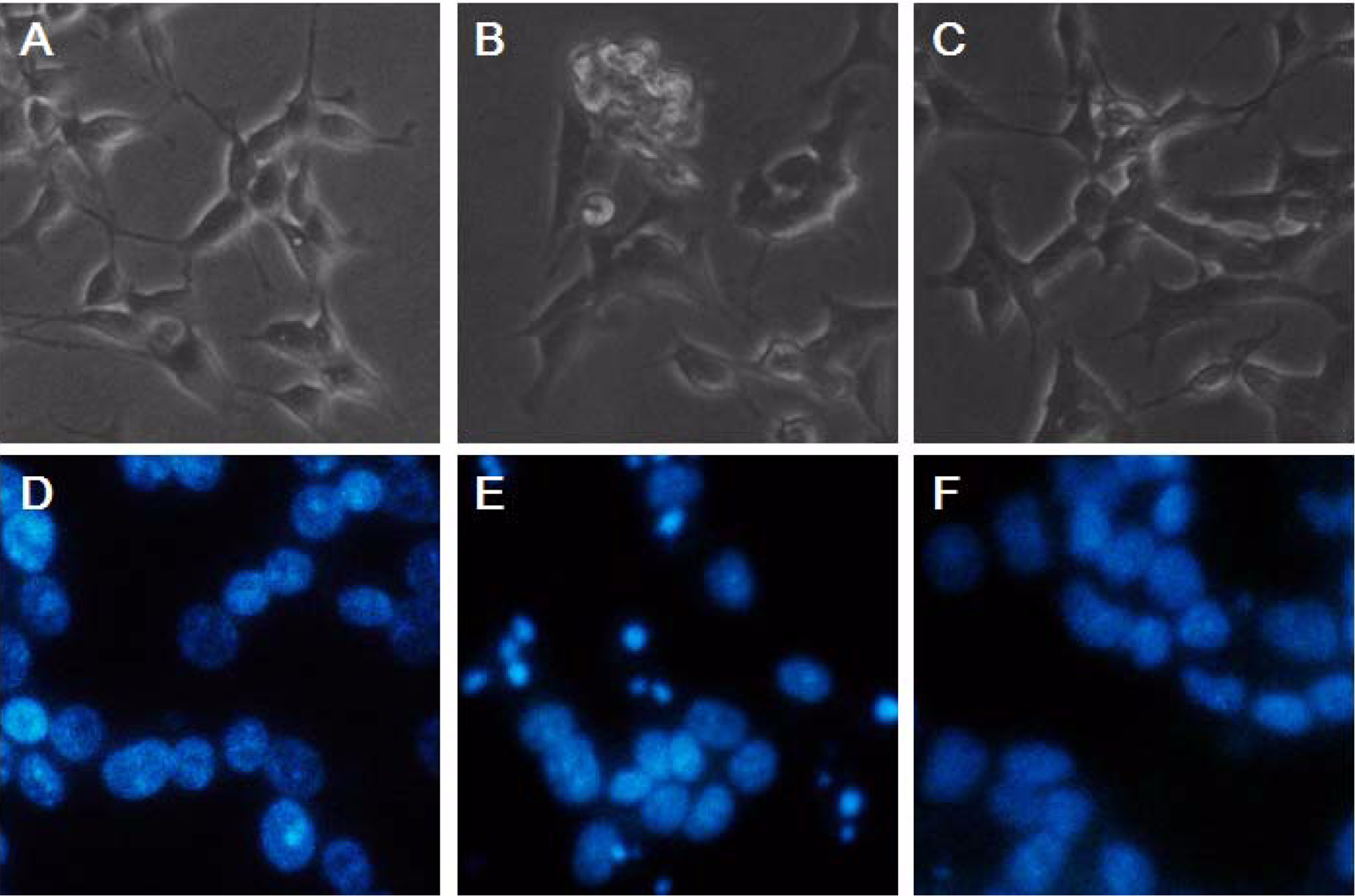 에 의한 신경세포 사멸에 대한 3-HK 의 보호효과 Magnolol Effect of magnolol on 3-HK-induced neuronal cell death. (a) SH-SY5Y cells were replaced with 1%FBS/DMEM 2 h prior to the 3-HK treatment.