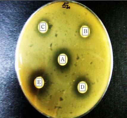 40 ND Bacterides fragilis 27.23±0.32 23.60±0.85 ND Clstridium perfingens 13.65±1.63 16.48±1.59 ND Clstridium difficile 15.85±2.05 14.40±2.