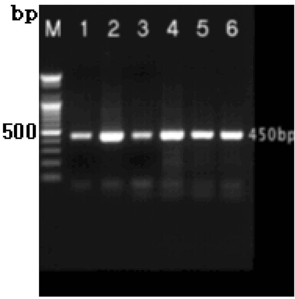 amplified products obtained by nested PCR amplification of cervical swab samples for Herpes simplex virus.