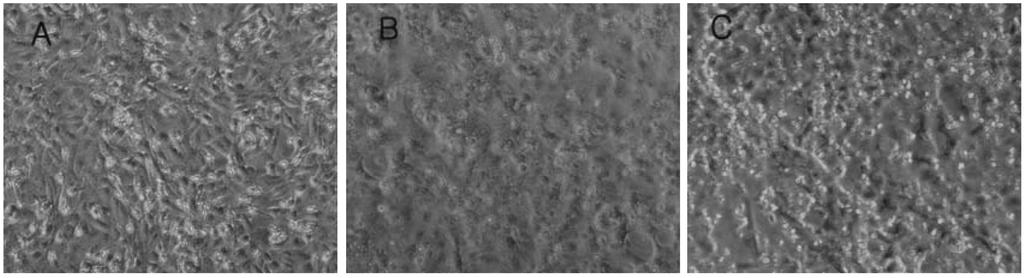 amplified products of Herpes virus simplex type 1 (138 bp), Lane 4: second PCR amplified products of Herpes virus simplex type (11 bp), Lane 5: negative control. Fig. Kor. J.