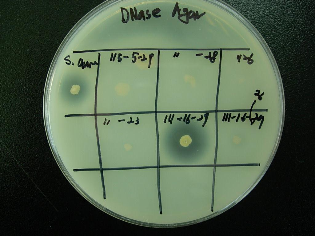 [ 그외황색포도상구균실험방법 1. DNase 시험 ; 내열성 DNase 생산여부확인 2. blood agar 시험 : 용혈인자확인 [DNase : 양성 [blood agar: 양성 4.